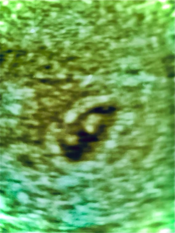 thank you for your&nbsp;patience